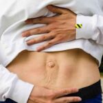 How Multiple Pregnancies and Diastasis Recti Can Make a Tummy Tuck Medically Necessary