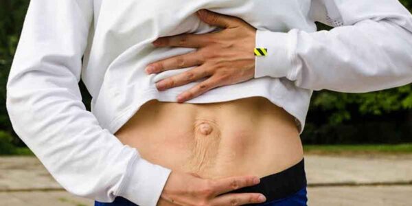 How Multiple Pregnancies and Diastasis Recti Can Make a Tummy Tuck Medically Necessary