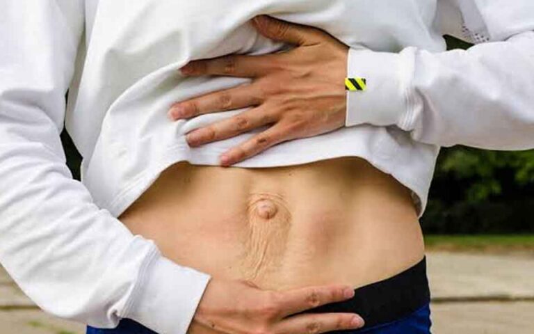 How Multiple Pregnancies and Diastasis Recti Can Make a Tummy Tuck Medically Necessary